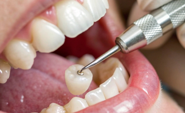 Initial Consultation